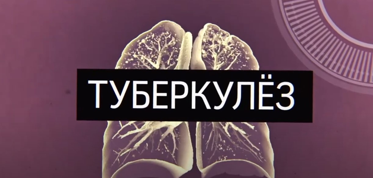 Туберкулез видеоролик